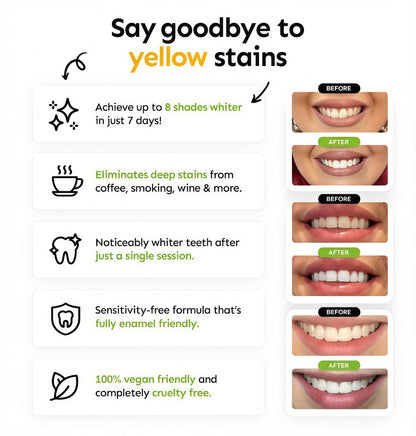 Tiras blanqueadoras de dientes AUROXEN