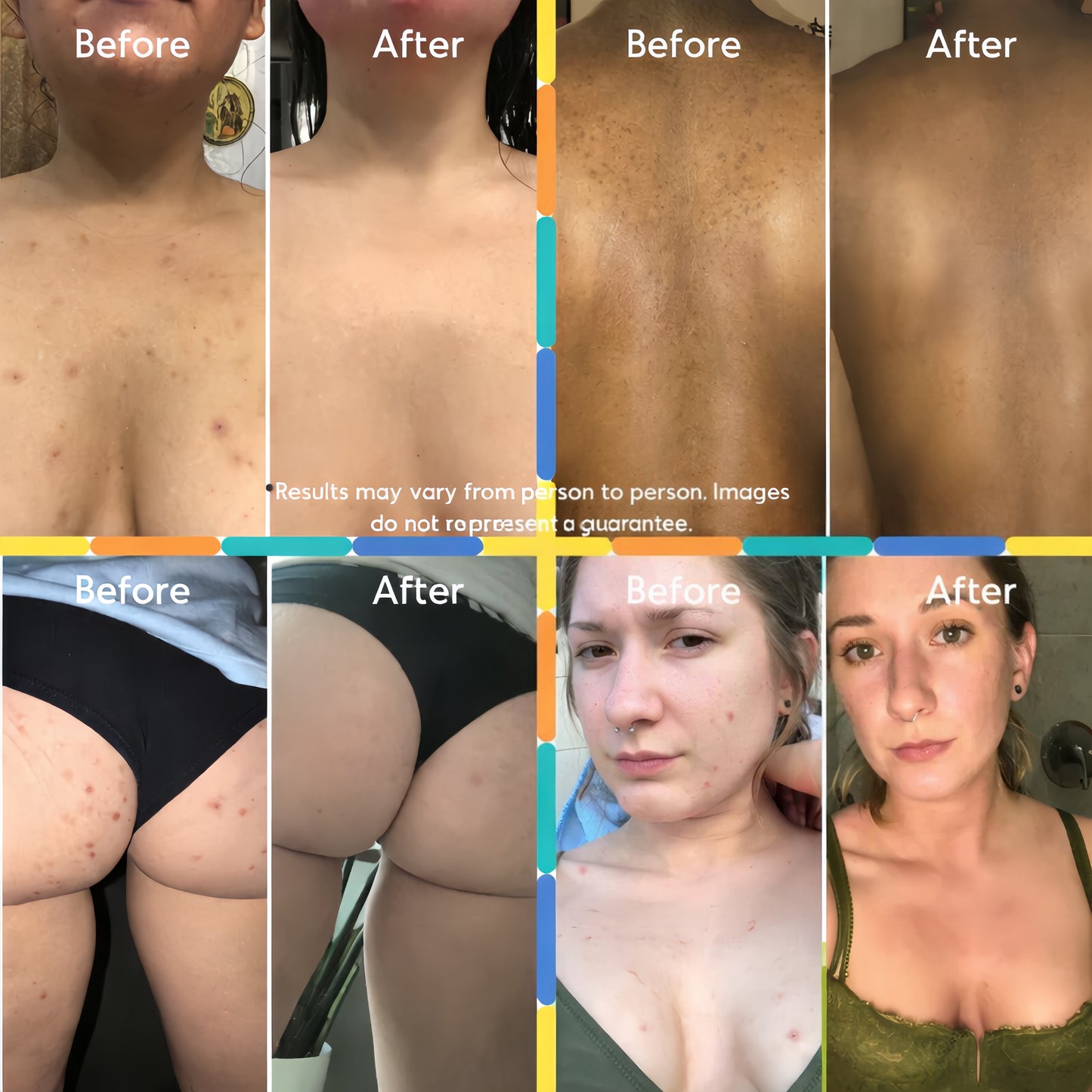 Mandelic Acid Body Serum