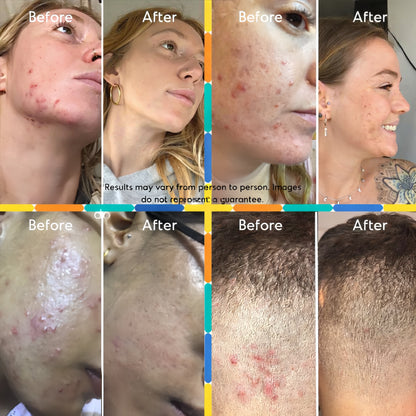 Mandelic Acid Body Serum